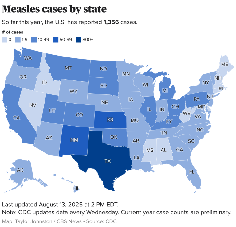 Map shows more than 1,300 measles cases across U.S. as outbreak grows